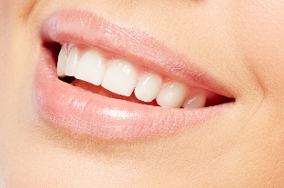 blanchiment dentaire cannes 06 Blanchiment des dents Cannes 06